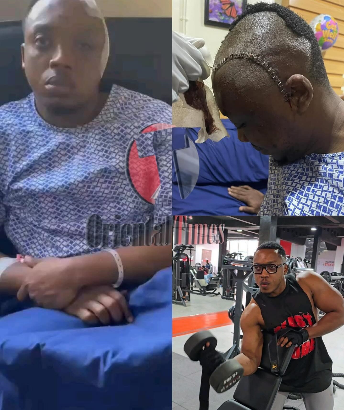 I’m grateful to God for life: man shares photo of brain tumour surgery. I’m grateful to God for life: man shares photo of brain tumour surgery.